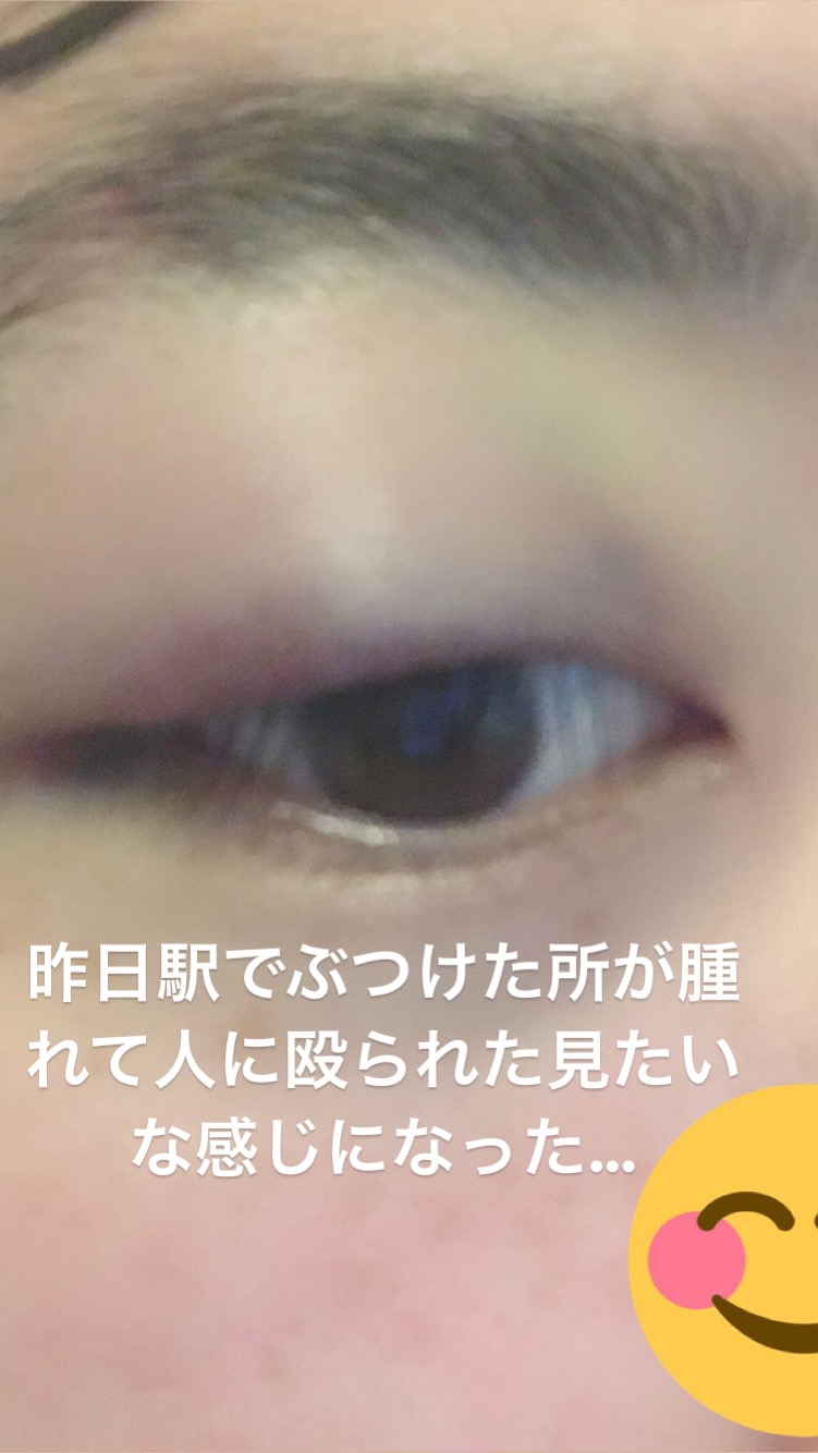 ブログ写真